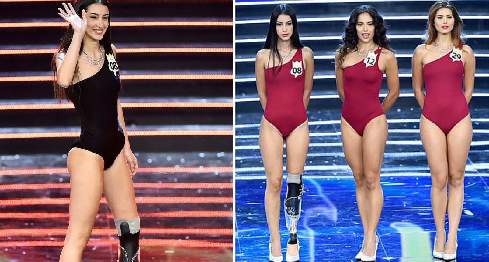 This Beauty with a Prosthetic Leg Has Made it to the Final’s of Miss Italy!