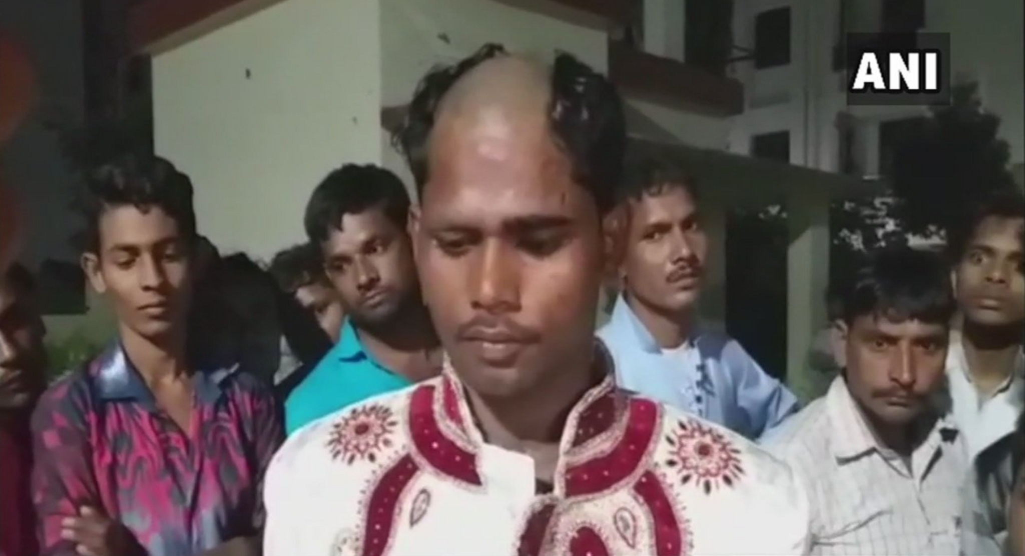 Groom’s Head Shaved Off by Bride’s Family After He Demanded Dowry During Wedding!