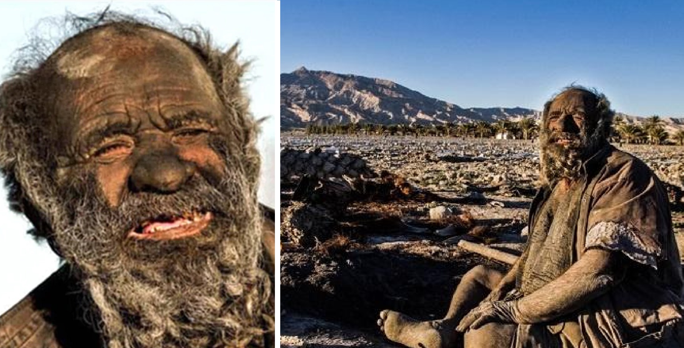 Amou Haji – Who Went Viral As ‘World’s Dirtiest Man’ Dies At 94, Months After Taking First Bath In 60 Years