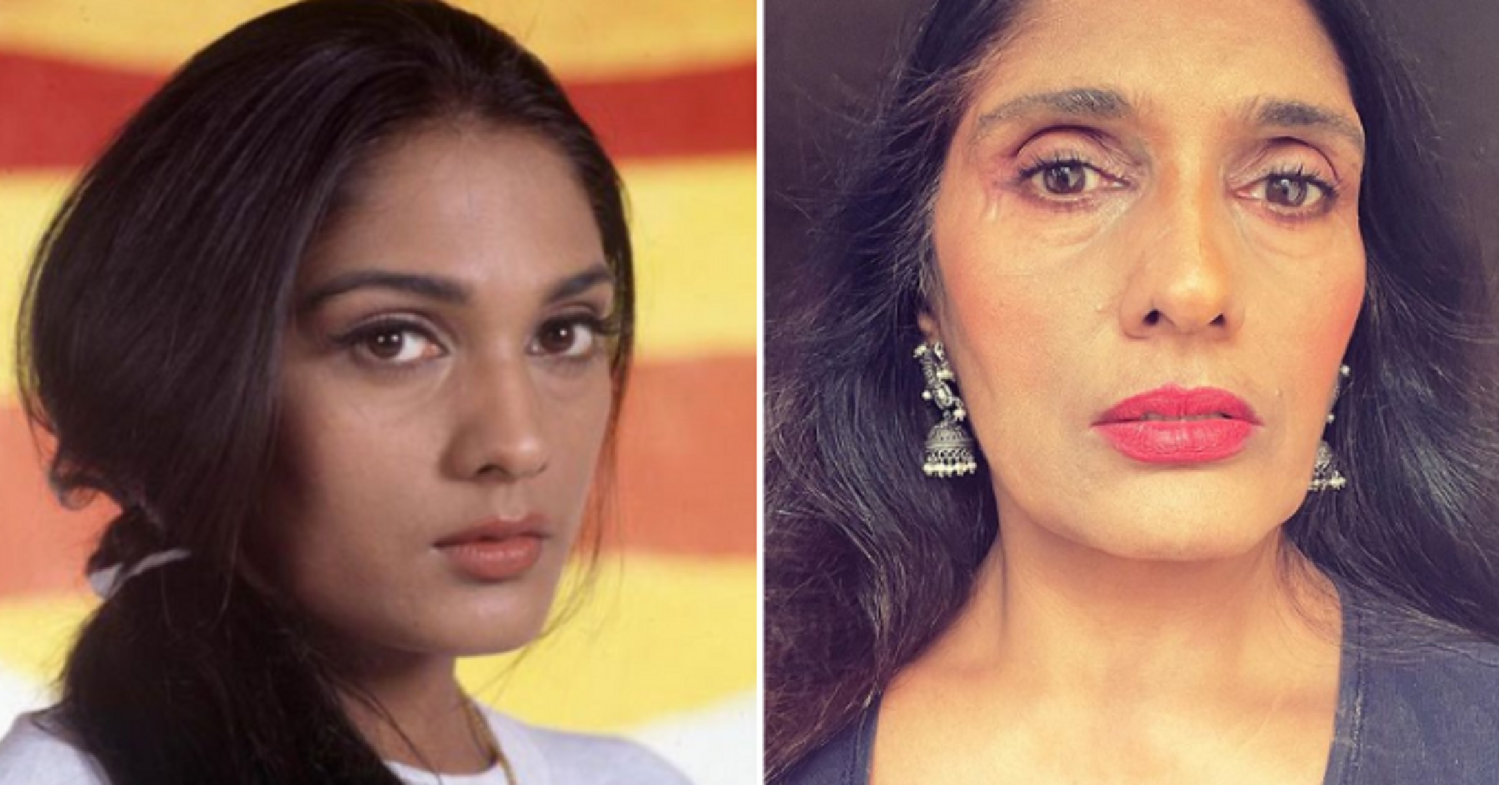 Aashiqui Actress Anu Aggarwal Remembers Horrific Car Accident That Severely Injured Her Face & Sent Her In Coma