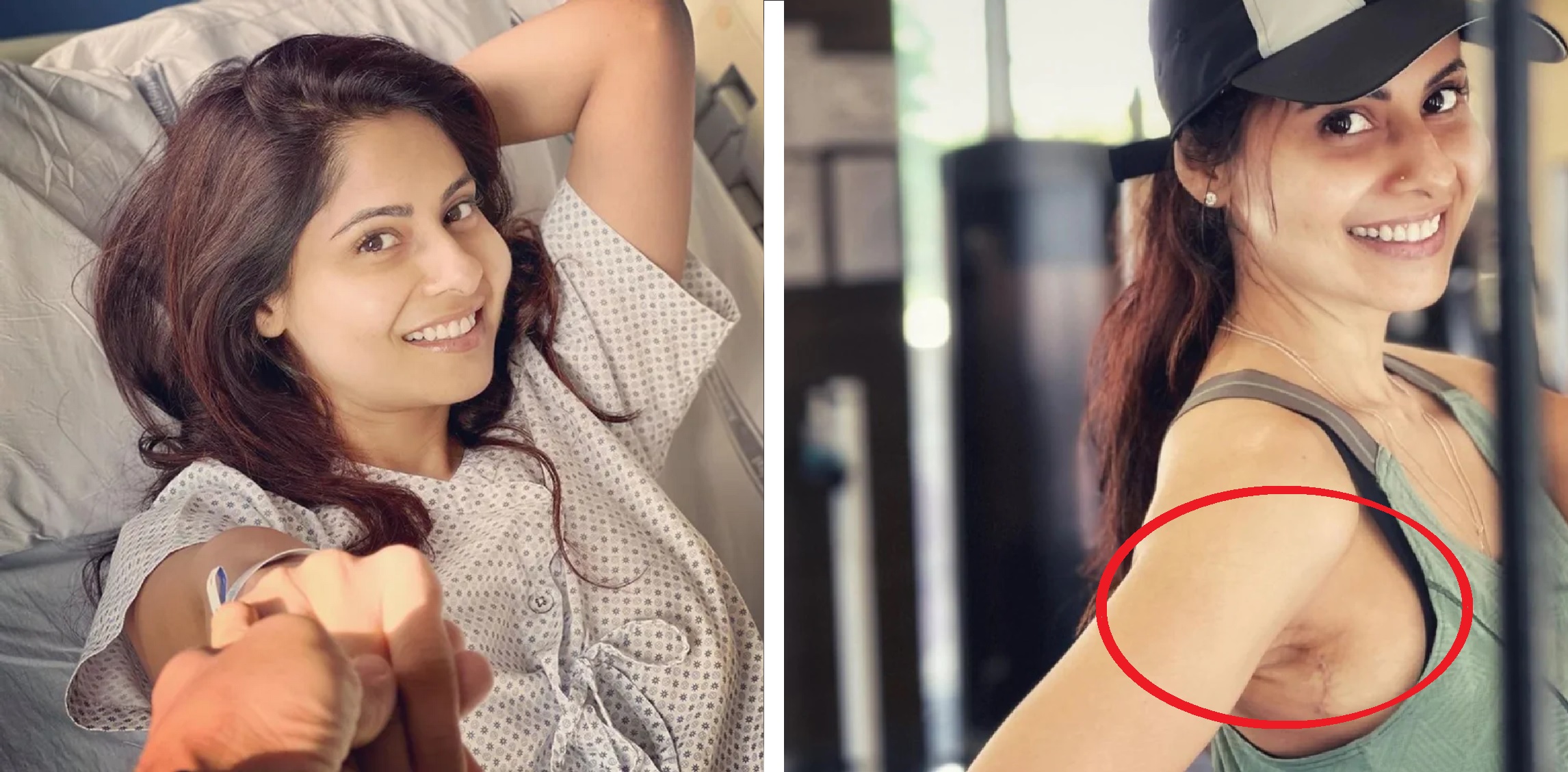 Chhavi Mittal’s Breast Cancer Surgery Successfully Completed: Actress Hits The Gym Just Weeks After