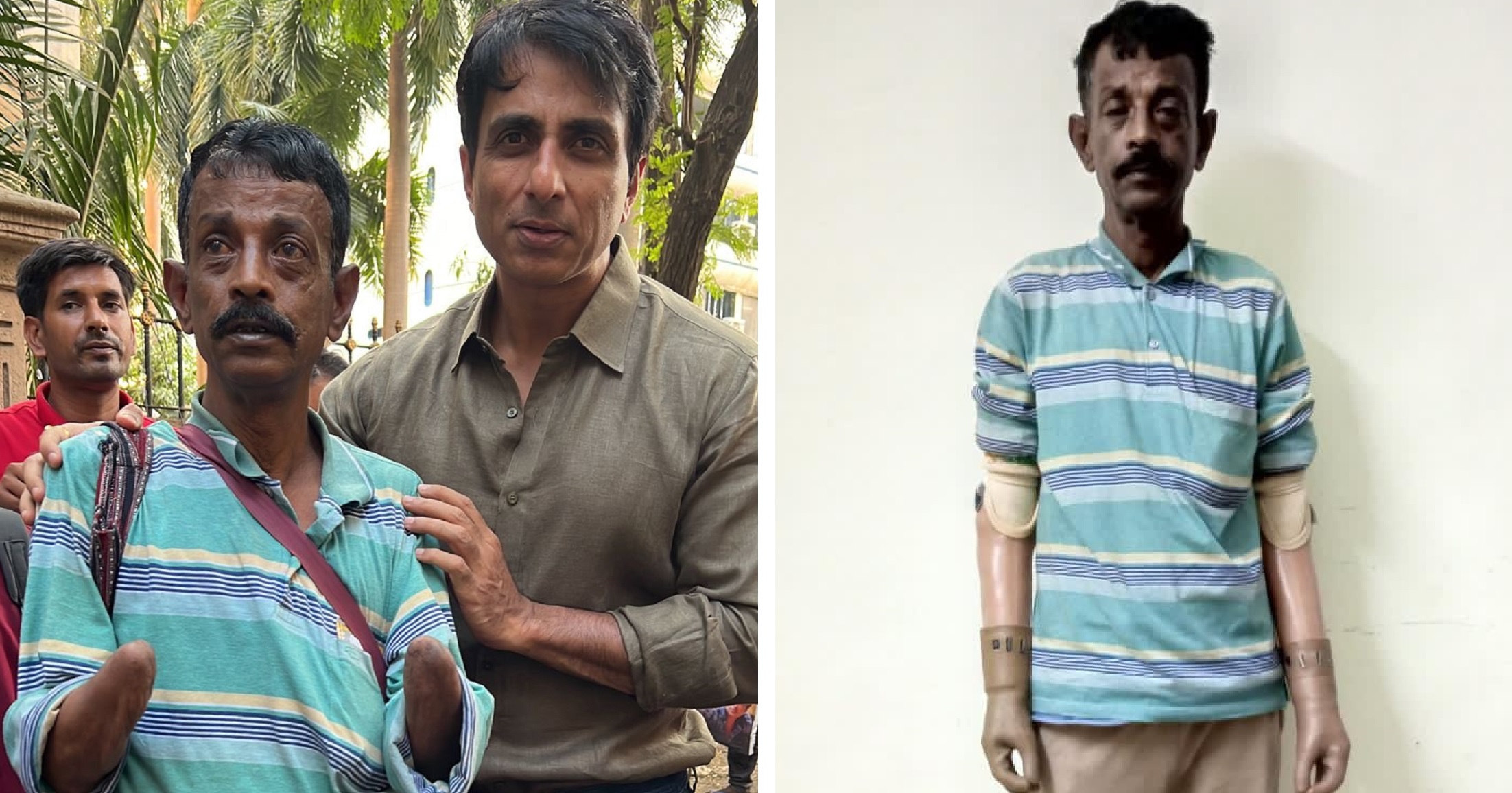 Sonu Sood Helps Man With Amputated Hands, Gives New Lease Of Life With Prosthetic Hands