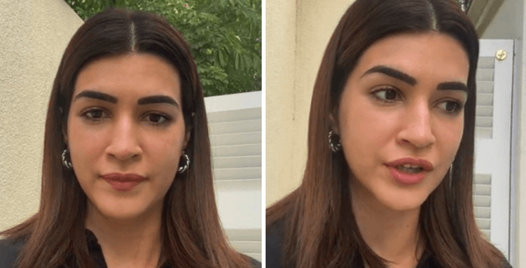Kriti Sanon Gets Trolled For Her Look In New Video, Fans Accuse Her Of Botox and Fillers